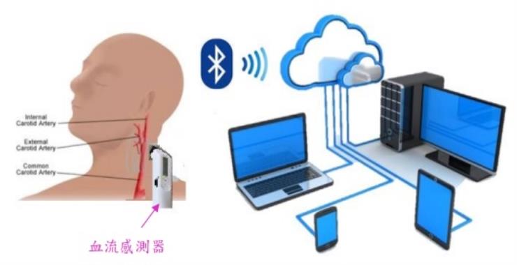 blood flow sensor  system