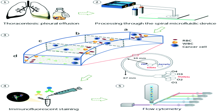 Sample processing workflow with the spiral microfluidic channels.